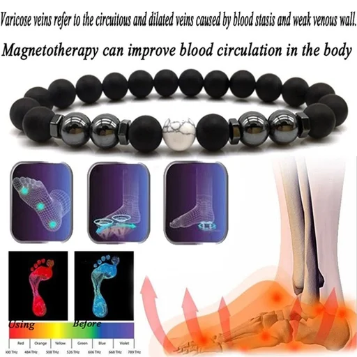 Anti Varicose and Swelling Magnetotherapy Anklet