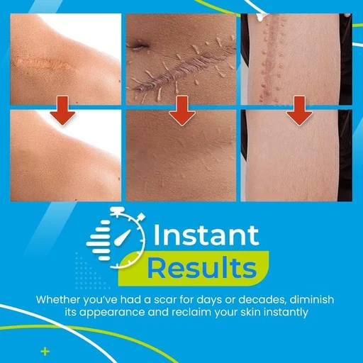Surgery Scar Removal Silicone Gel Patch