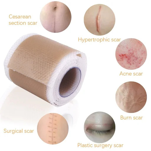 Surgery Scar Removal Silicone Gel Patch