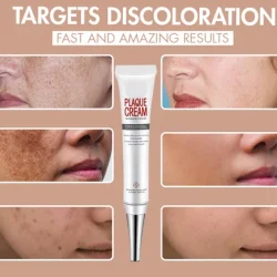 Zero Dark Wizard Whitening Freckle Cream Dark Spot Corrector Remover for Face and Body