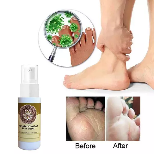 Anti-Fungal Treatment Spray Fungal Combat Feet Spray