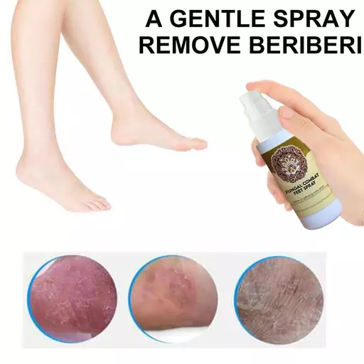 Anti-Fungal Treatment Spray Fungal Combat Feet Spray