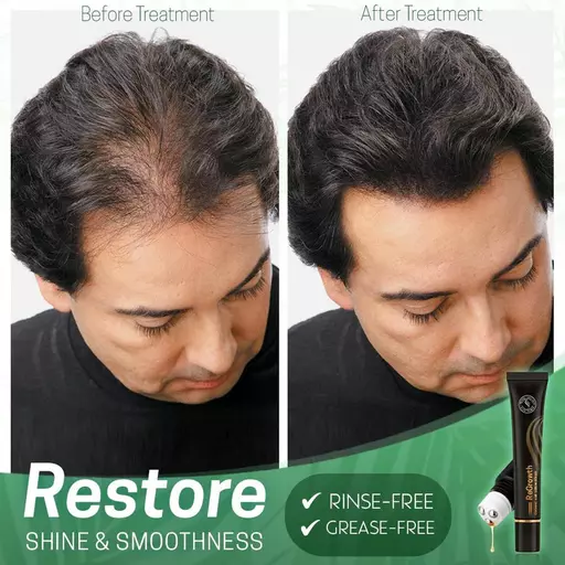ReGrowth Organic Hair Serum Roller Set Biotin Hair Growth Serum