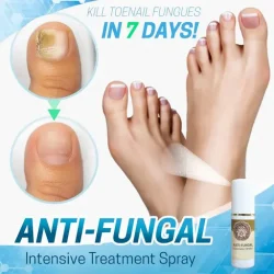 Anti-Fungal Treatment Spray
