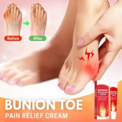 Sumifun Bunion Pain Relief Cream